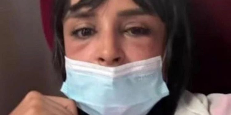 مؤثرة مغربية تتعرض لتشوه على مستوى الوجه بسبب تقنية “التكساس”