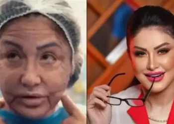 بعد عملية تجميلية فاشلة.. وفاء سالم تظهر بملامح شبابية