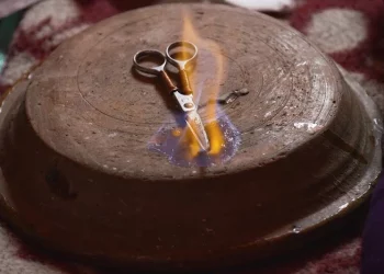 ختان تقليدي كيودي بحياة طفل بضواحي وزان‬