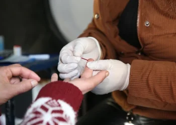 هذا هو عدد الإصابات بداء السيدا بالمغرب خلال سنة 2023