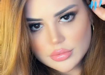 بسبب التنمر..فاطمة الزهراء لحرش تتخلى عن “الفيلر”