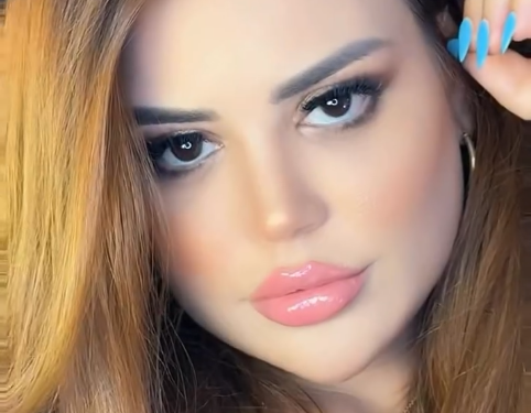 بسبب التنمر..فاطمة الزهراء لحرش تتخلى عن “الفيلر”