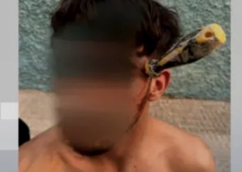 اعتداء دموي في إسبانيا.. مفك مغروس في جمجمة شاب بعد تصفية حسابات
