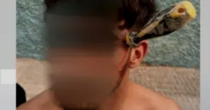 اعتداء دموي في إسبانيا.. مفك مغروس في جمجمة شاب بعد تصفية حسابات