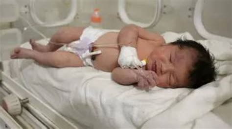 ولادة مفاجئة داخل المستشفى بعد الاشتباه بحصى في الكلى تثير الدهشة