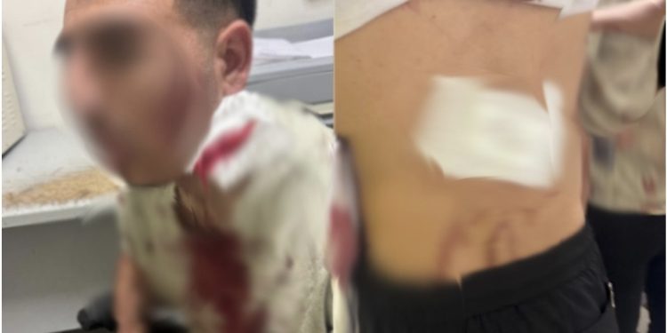 محاولة سرقة تتحول إلى اعتدا-ء دمو-ي بالبرنوصي.. وضحي-ة يكشف معاناته النفسية