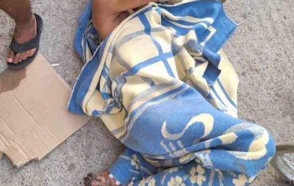 تعف-ن رجله يهدد حياته.. استغاثة عاجلة لإيواء وعلاج مواطن دون مأوى بالقنيطرة