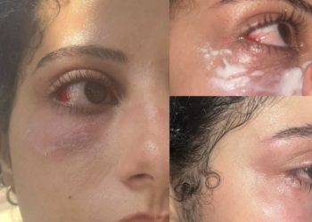 اعتدا-ء  وسرقة حقيبة.. فتاتان ترويان تفاصيل واقعة بالقصر الكبير