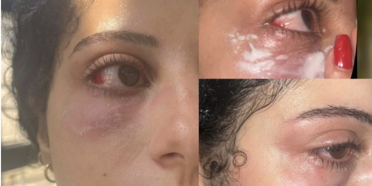 اعتدا-ء وسرقة حقيبة.. فتاتان ترويان تفاصيل واقعة بالقصر الكبير