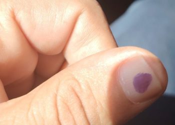 من مكاتب التصويت إلى منصات التواصل.. صور «الأصابع الملطخة بالمداد» تتصدر المشهد